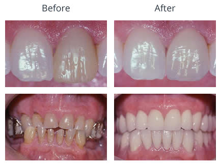 Before and After Treatment